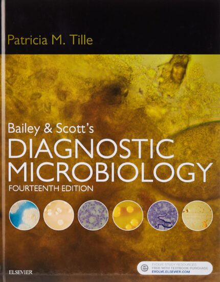 Test Bank for Bailey and Scotts Diagnostic Microbiology 14th Edition by Tille